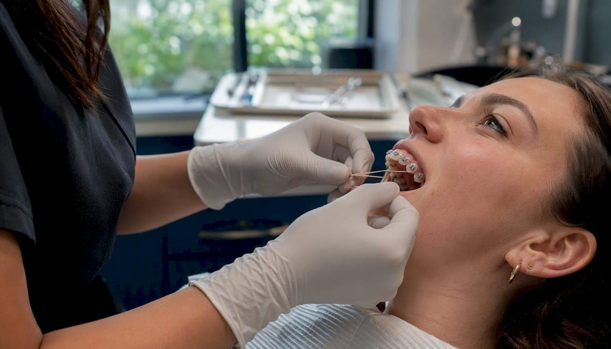 Invisalign Elastics: Wear, Care & Troubleshooting Guide