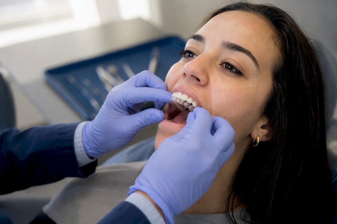 Clear Aligners Cost: What You'll Actually Pay