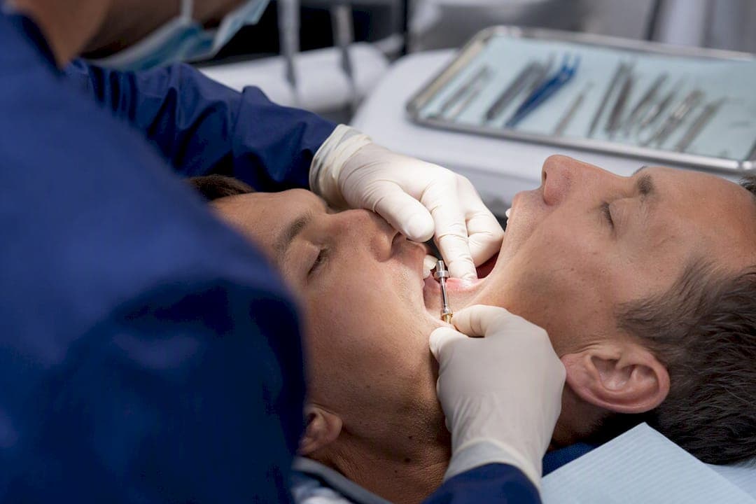 Mini Dental Implants: Benefits, Costs, and Candidacy
