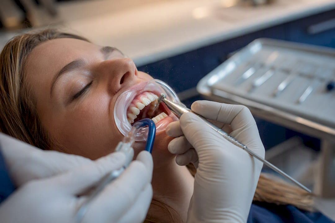 Ask for an X Ray First: Tooth Reshaping in Washington, DC