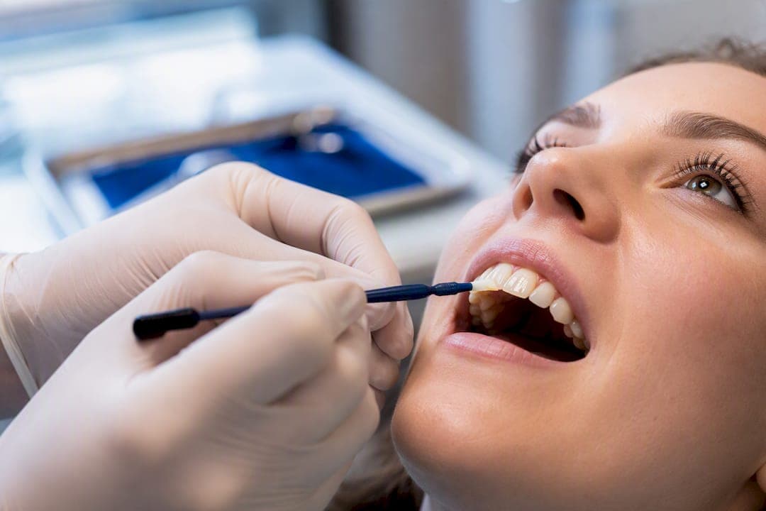Twice Yearly or More: Fluoride Treatment Benefits and Who Needs It