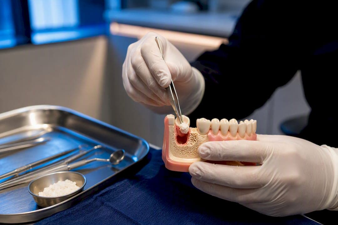 Cut Bone Loss in Half Before an Implant With Socket Preservation