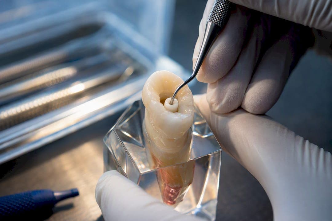 2 mm Barrier First: Safe Internal Bleaching in Washington, DC