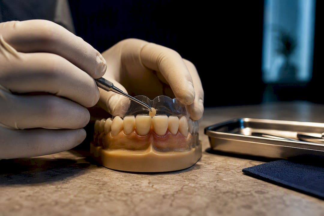 One Visit Black Triangle Treatment, Washington, DC: Composite First