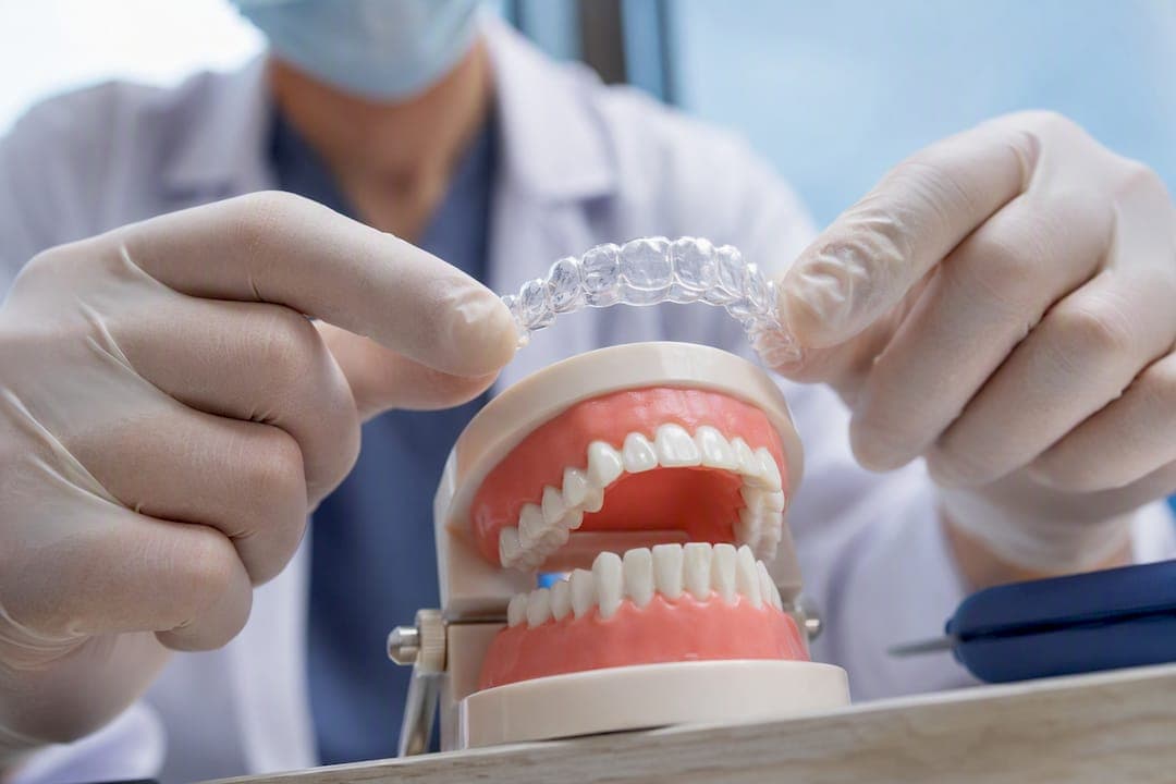 About 38%: Clinician Take on Aligners for Overbites in Adults & Teens